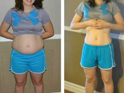 Linda R. Denver Colorado KetoVera weight loss drops before after